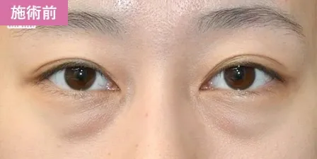 施術事例2