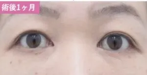 施術事例3