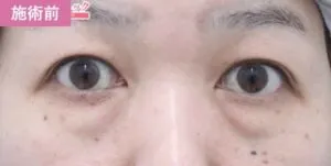 施術事例3