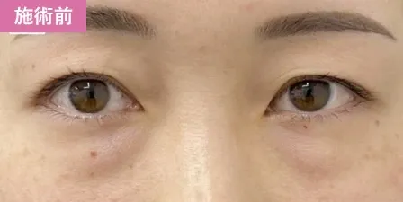 施術事例3